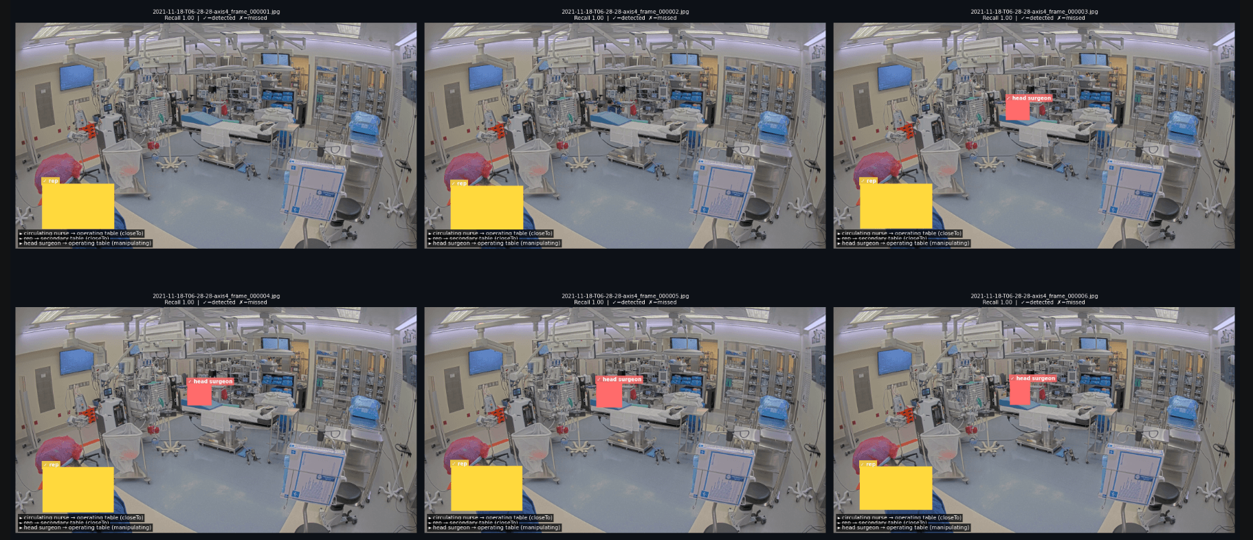 Multimodal OR Video Analytics Pipeline screenshot 4