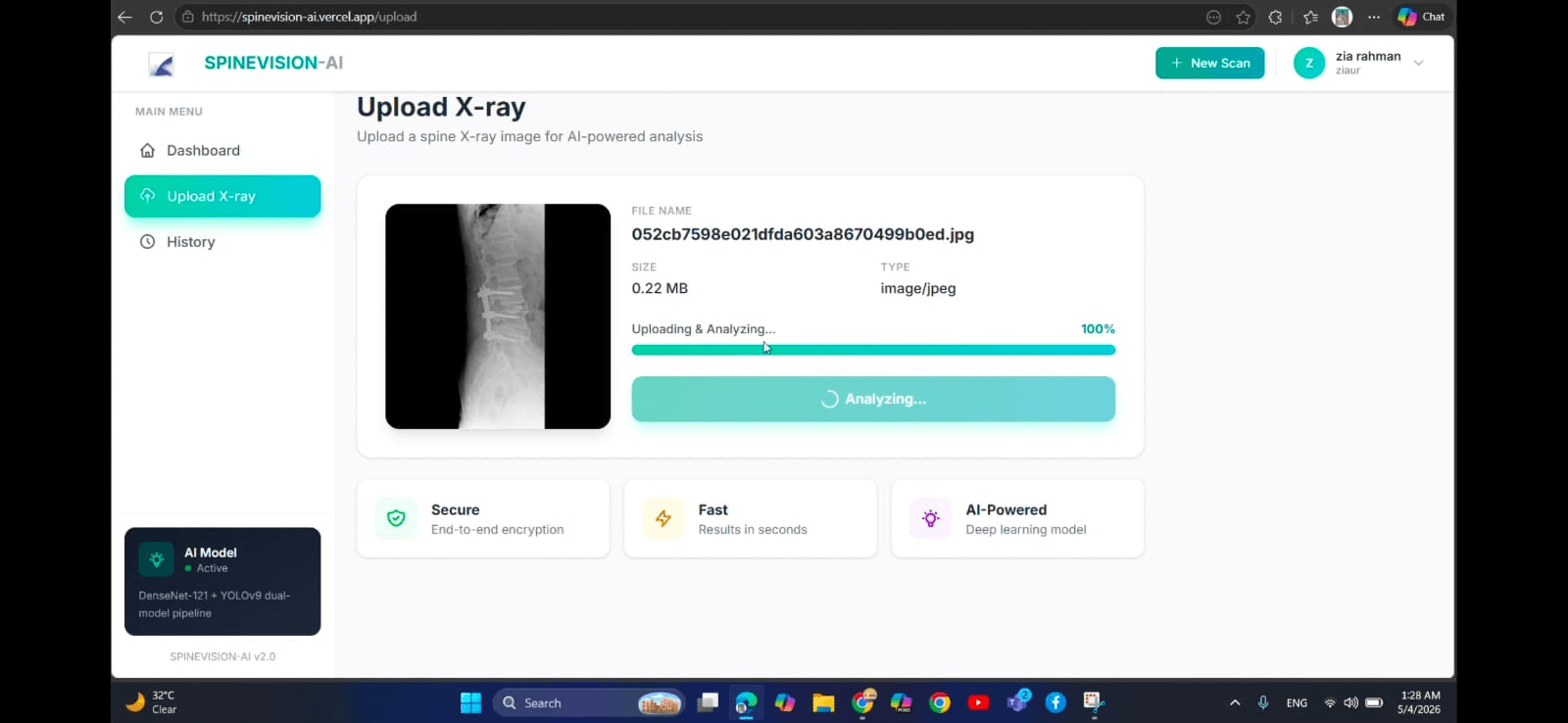 SpineVision AI - Spine Disease Detection from X-Ray screenshot 2