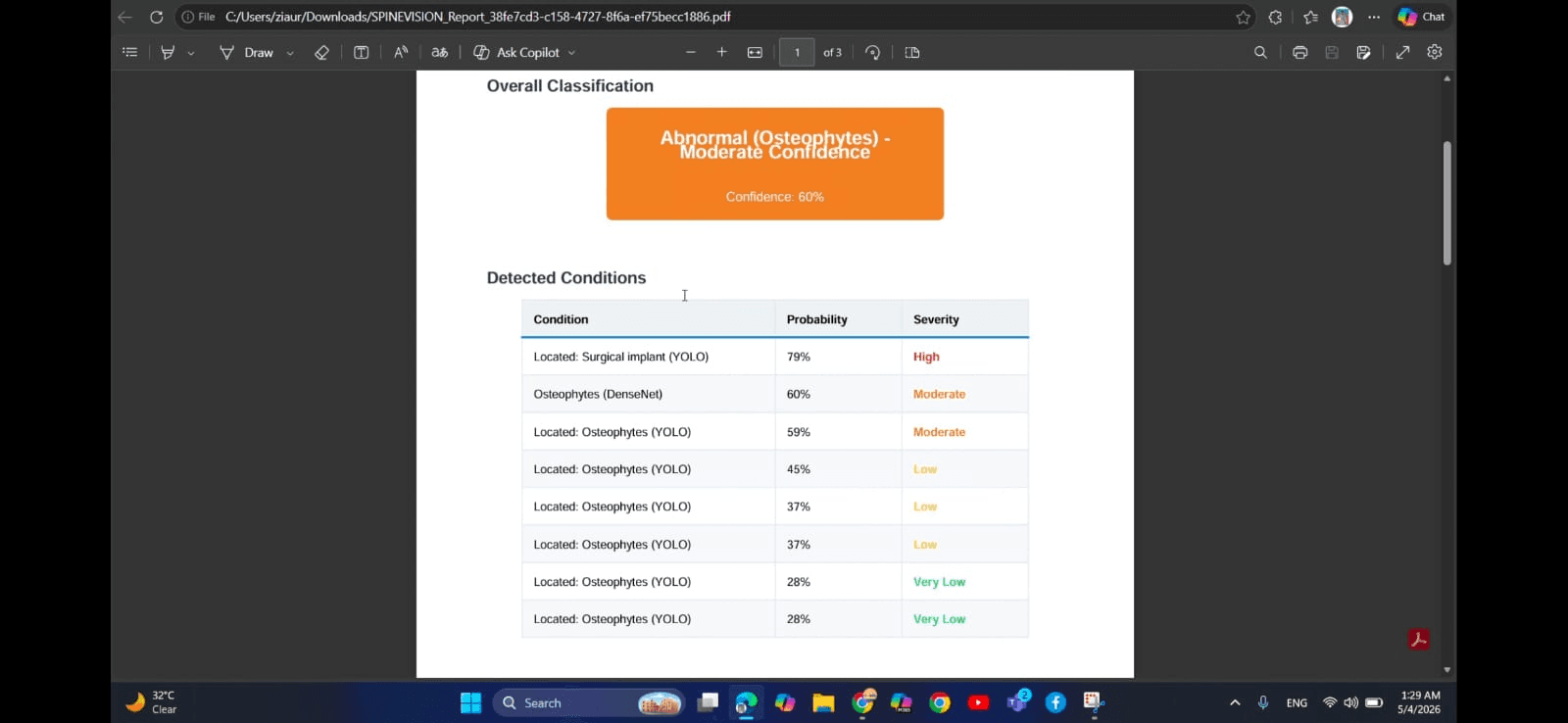 SpineVision AI - Spine Disease Detection from X-Ray screenshot 7