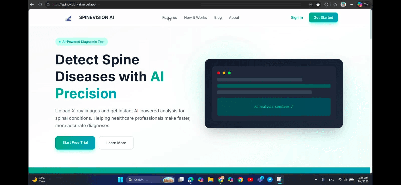 SpineVision AI - Spine Disease Detection from X-Ray screenshot 1